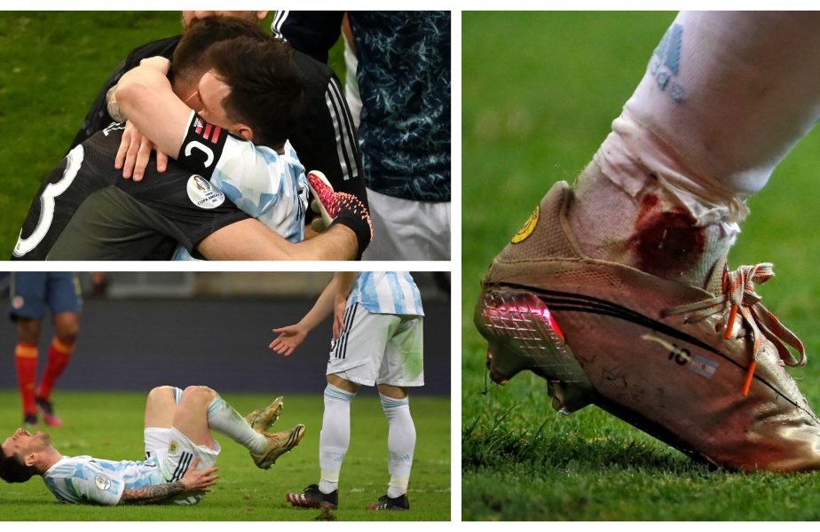 Dramatism total în Argentina – Columbia! Lionel Messi a jucat cu glezna plină de sânge. Portarul Emiliano Martinez a apărat 3 penalty-uri