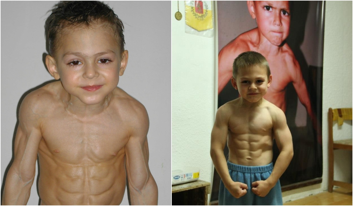 Cum a ajuns să arate „Micul Hercule”, copilul care a şocat România când avea 2 ani. Giuliano Stroe a devenit major şi e de nerecunoscut