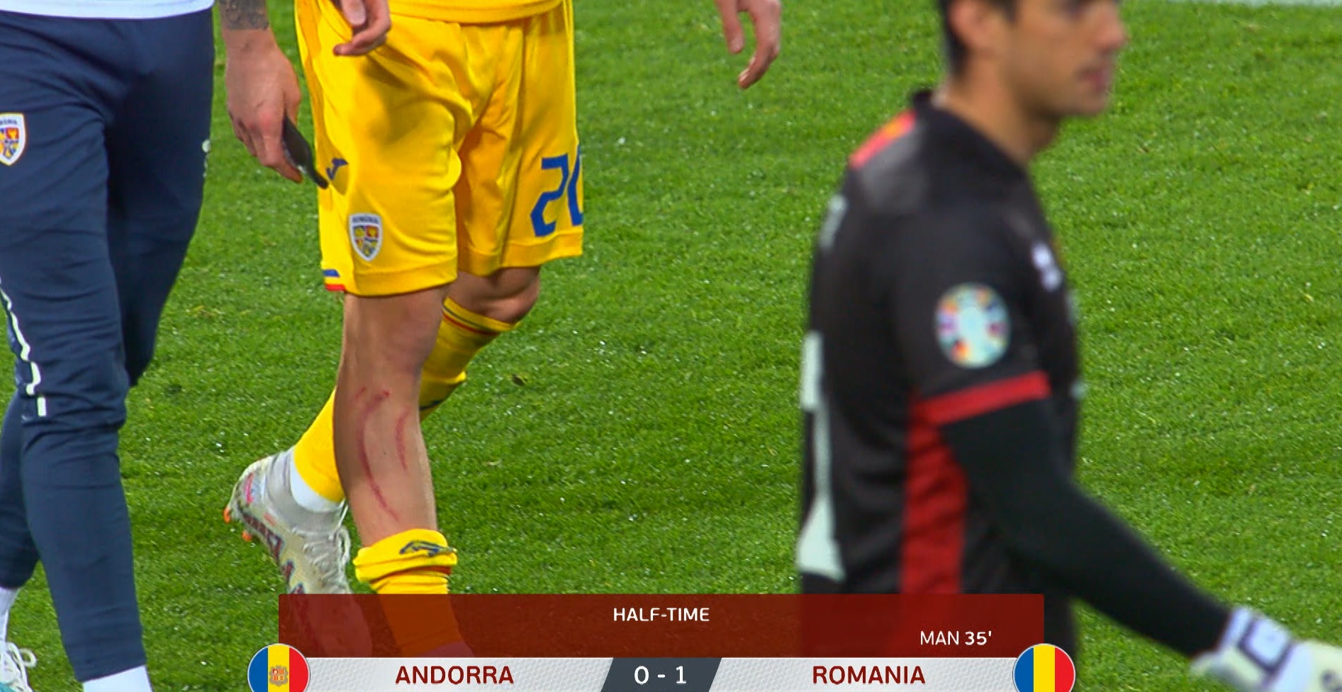 Andorra - România LIVE VIDEO Dennis Man, lovit teribil în finalul primei reprize