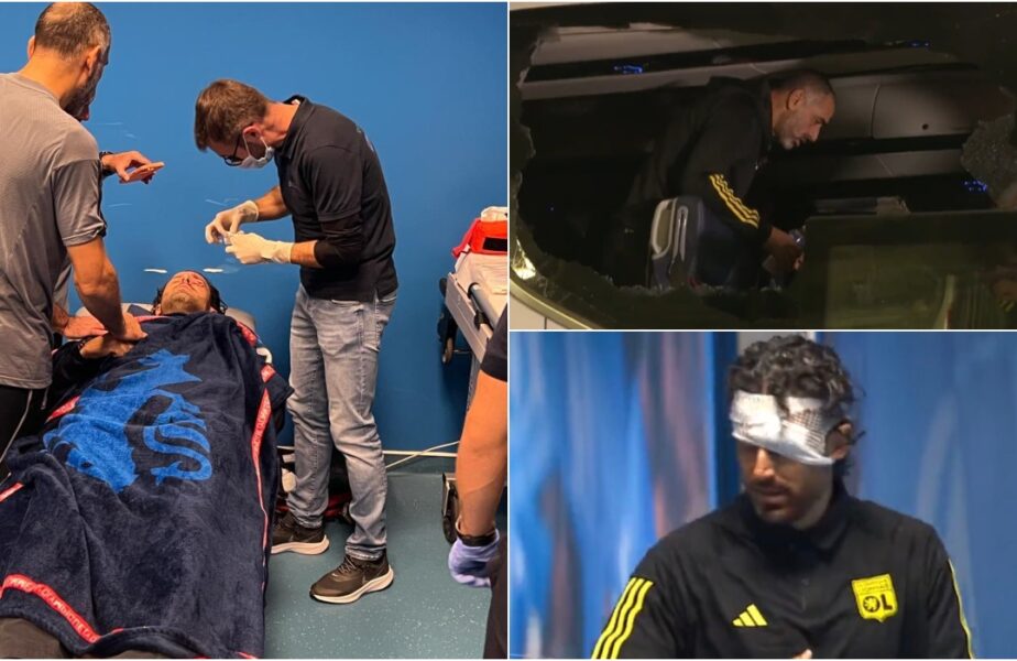 Incidente uluitoare înainte de Marseille – Lyon! Fabio Grosso a fost umplut de sânge. Meciul nu se va juca în această seară