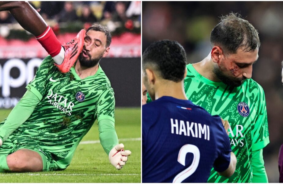 Verdictul medicilor, după ce Gianluigi Donnarumma a fost desfigurat! Accidentare horror suferită de portarul lui PSG