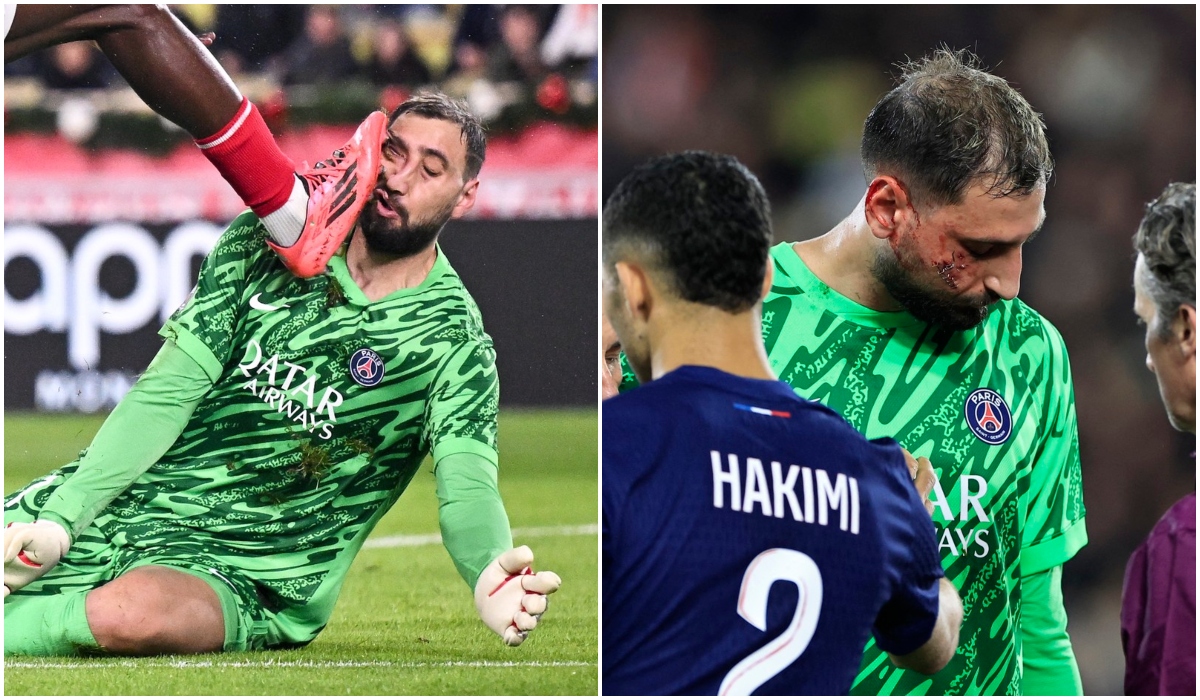 Verdictul medicilor, după ce Gianluigi Donnarumma a fost desfigurat! Accidentare horror suferită de portarul lui PSG